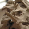 Osteoporose